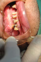 %_tempFileNameImplant%20118c1%