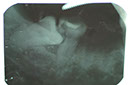 %_tempFileNameImplant%2011a2%