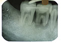 %_tempFileNameImplant%2011b5%