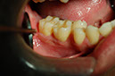 %_tempFileNameImplant%2011c8%