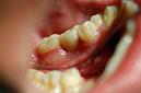 %_tempFileNameImplant%2011d2%