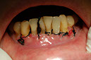 %_tempFileNameImplant%2012d1%