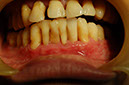 %_tempFileNameImplant%2012g4%