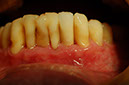 %_tempFileNameImplant%2012g5%
