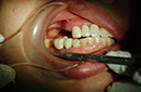 %_tempFileNameImplant%2015a2-1%