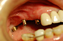 %_tempFileNameImplant%2015a3-1%