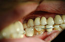 %_tempFileNameImplant%2015a3-3%