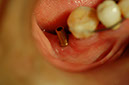 %_tempFileNameImplant%2015a4-1%