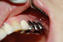 %_tempFileNameImplant%2015a5%