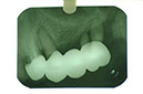 %_tempFileNameImplant%2015a6%