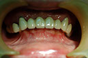%_tempFileNameImplant%2017a1%