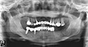 %_tempFileNameImplant%2017d2%
