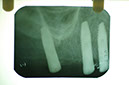 %_tempFileNameImplant%2018c%