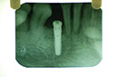 %_tempFileNameImplant%201b2%