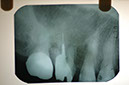 %_tempFileNameImplant%2023a1%