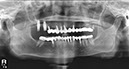 %_tempFileNameImplant%2024e3%