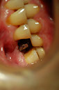 %_tempFileNameImplant%2025c%