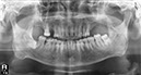 %_tempFileNameImplant%2025e1%
