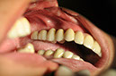%_tempFileNameImplant%2026e%