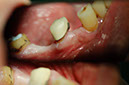 %_tempFileNameImplant%2027a1%