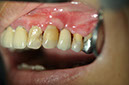 %_tempFileNameImplant%2028c1%