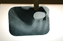 %_tempFileNameImplant%202b1%