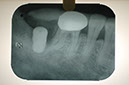 %_tempFileNameImplant%202b2%