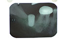 %_tempFileNameImplant%202e%