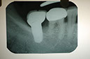 %_tempFileNameImplant%202f2%