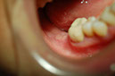 %_tempFileNameImplant%202g%