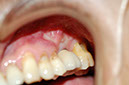 %_tempFileNameImplant%202r2%
