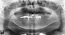 %_tempFileNameImplant%2031k1%
