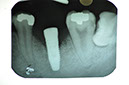 %_tempFileNameImplant%2032Lb2%
