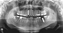 %_tempFileNameImplant%2032Lc3%