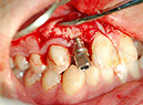 %_tempFileNameImplant%2032c1%