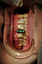 %_tempFileNameImplant%2032e1%