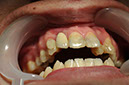%_tempFileNameImplant%2032e5%