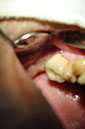 %_tempFileNameImplant%2034a%