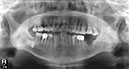 %_tempFileNameImplant%2034h1%