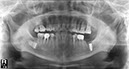 %_tempFileNameImplant%2034h2%