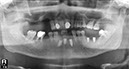 %_tempFileNameImplant%2036b2%