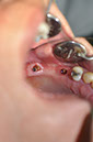 %_tempFileNameImplant%2037a2%