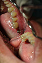 %_tempFileNameImplant%2039d%