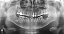 %_tempFileNameImplant%2039f%