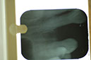 %_tempFileNameImplant%203a%