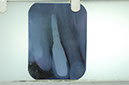 %_tempFileNameImplant%203c5%
