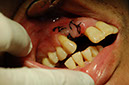 %_tempFileNameImplant%203e%