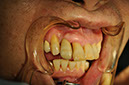 %_tempFileNameImplant%203m4%