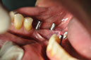 %_tempFileNameImplant%2040c7%