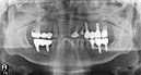 %_tempFileNameImplant%2040e3%